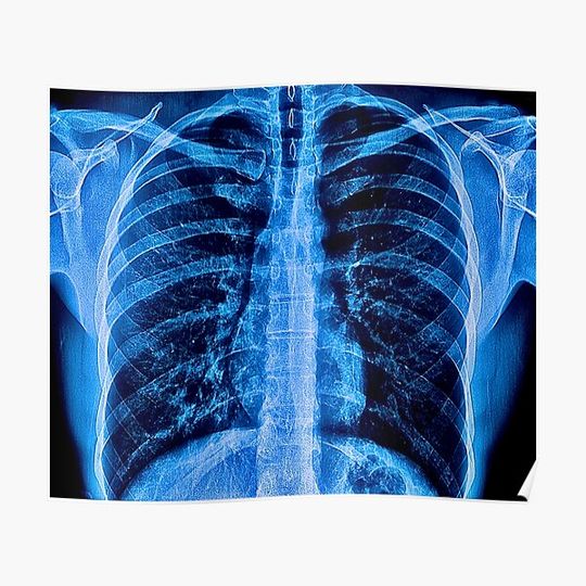 Discover Chest X-Ray Premium Matte Vertical Poster