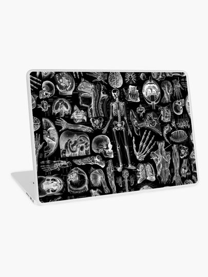 Discover Human Anatomy Black Print | Laptop Skin