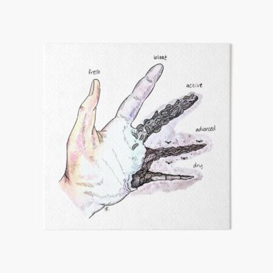 Discover Stages of Decay Hand by Skye Rain Art