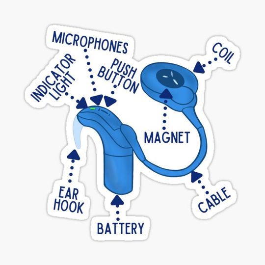 Discover Blue Cochlear Implant Parts and Pieces