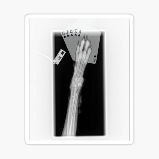 Discover X-ray
